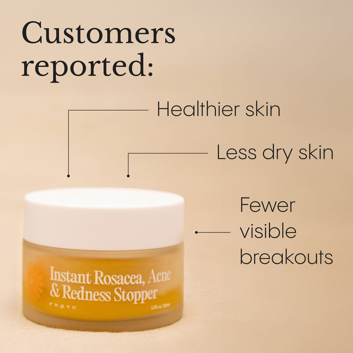 Balm for Acne-Prone Skin