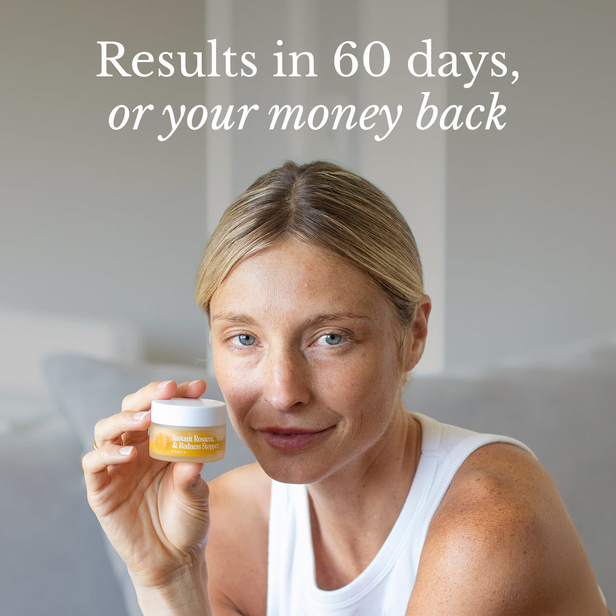 Balm for Acne-Prone Skin