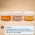 The Complete System for Acne-Prone Skin