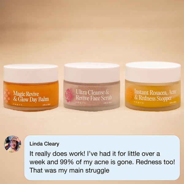 The Complete System for Acne-Prone Skin
